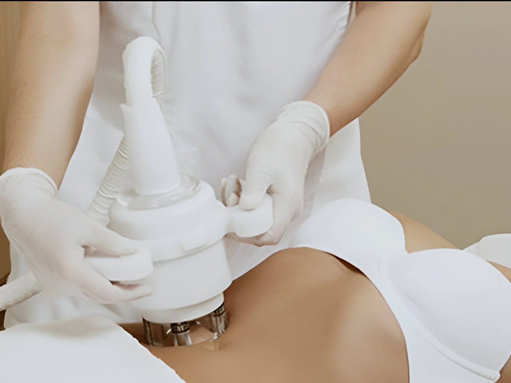 rf treatment